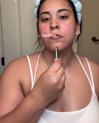 Silky Skin™ Tightening Kit